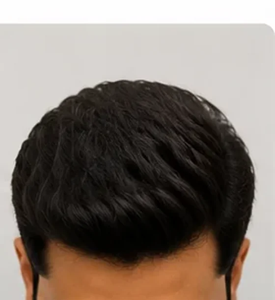 After - man with dense natural hair wig